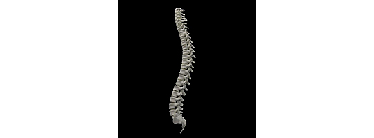 Dar Kanal Hastalığı (Spinal Stenoz)