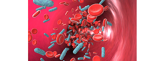 Sepsis (Kanda Enfeksiyon)